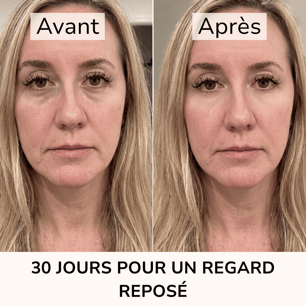 Patchs hydrogel caféine — Regard lissé, illuminé et décongestionné
