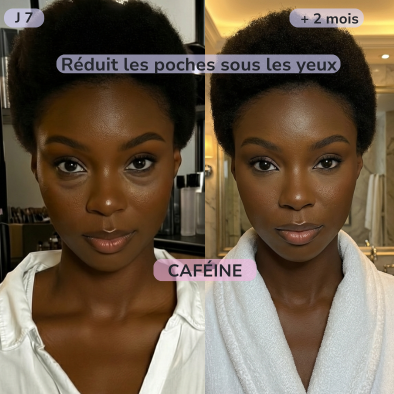 Patchs hydrogel caféine — Cure 30 jours pour un regard visiblement éclatant