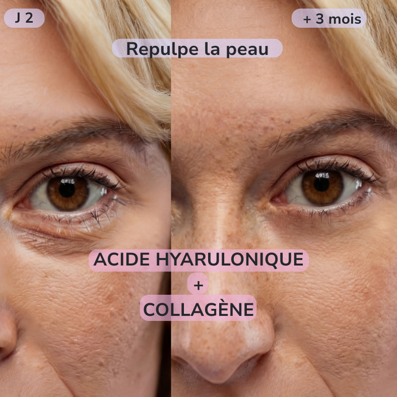 Patchs hydrogel caféine — Cure 30 jours pour un regard visiblement éclatant