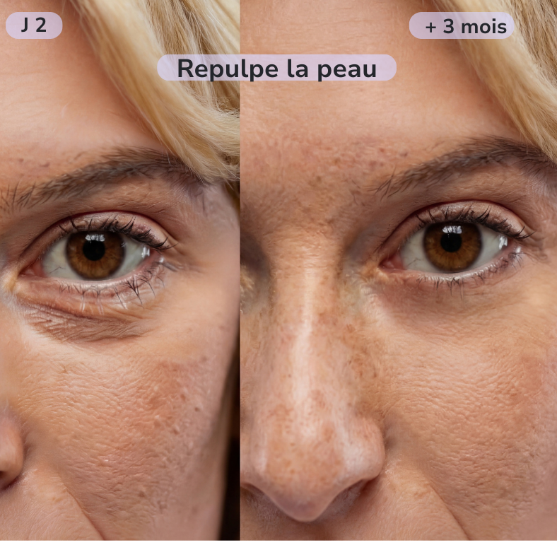 Patchs hydrogel caféine — Cure 30 jours pour un regard visiblement éclatant