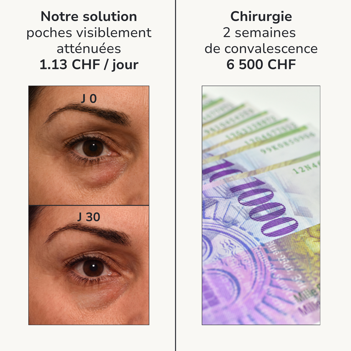Patchs hydrogel caféine — Regard lissé, illuminé et décongestionné
